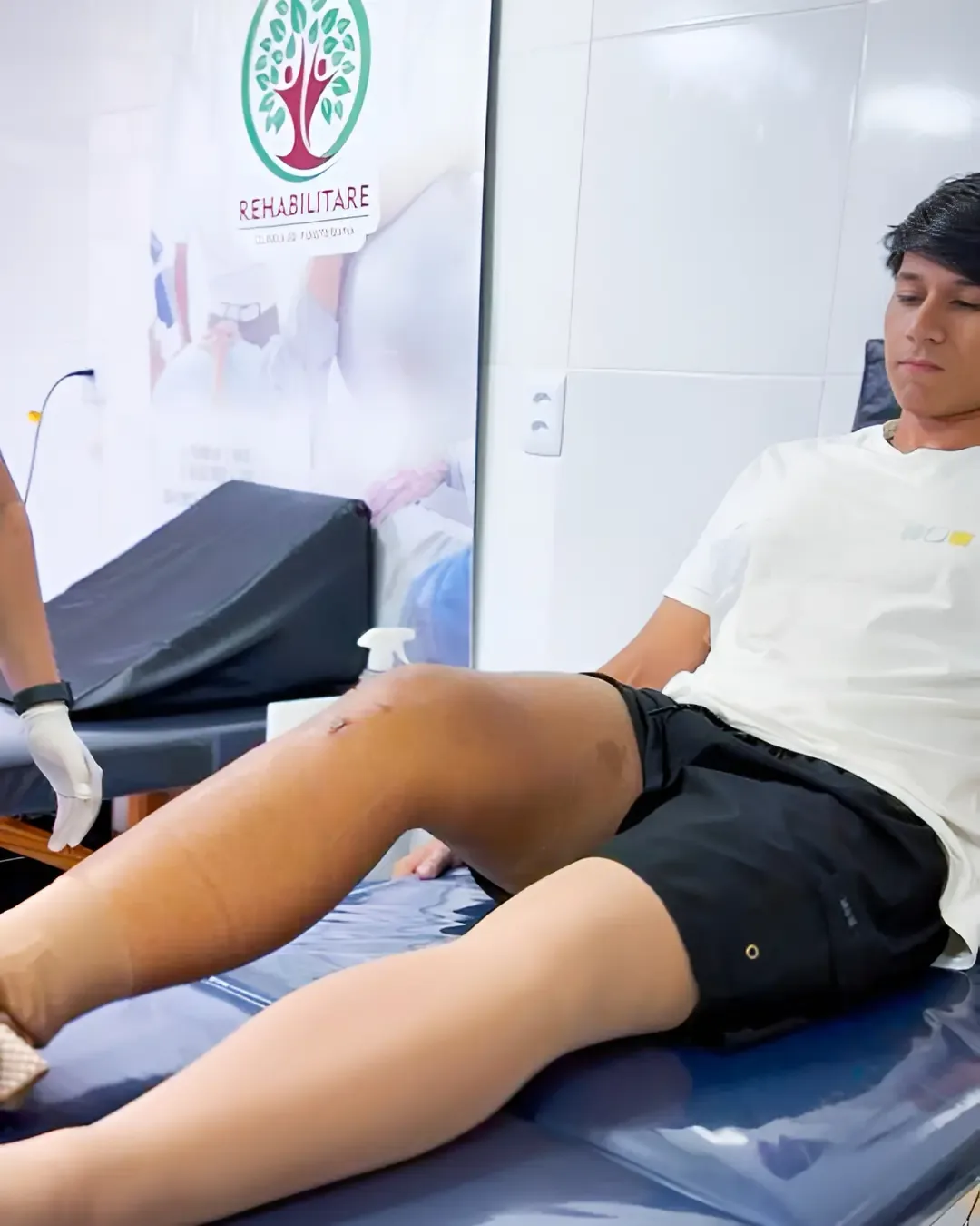 Fisioterapia Traumato Ortopédica - Recuperação pós-cirurgia na Rehabilitare Manaus